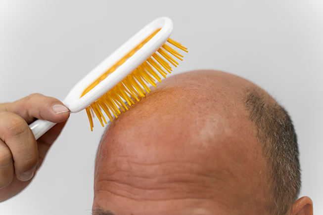 <a href='https://www.freepik.com/photos/hair-transplant'>Hair transplant photo created by freepik - www.freepik.com</a>