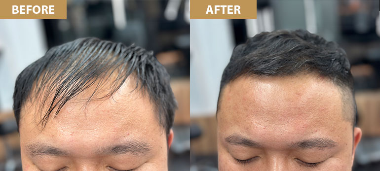 細軟髮男性燙髮前後對照圖